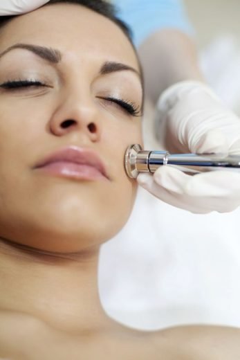 microdermabrasion